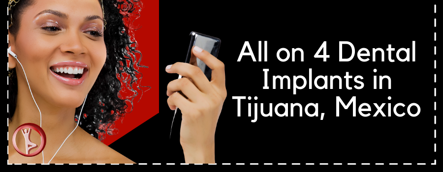 Cost of All on 4 Dental Implants in Tijuana, Mexico